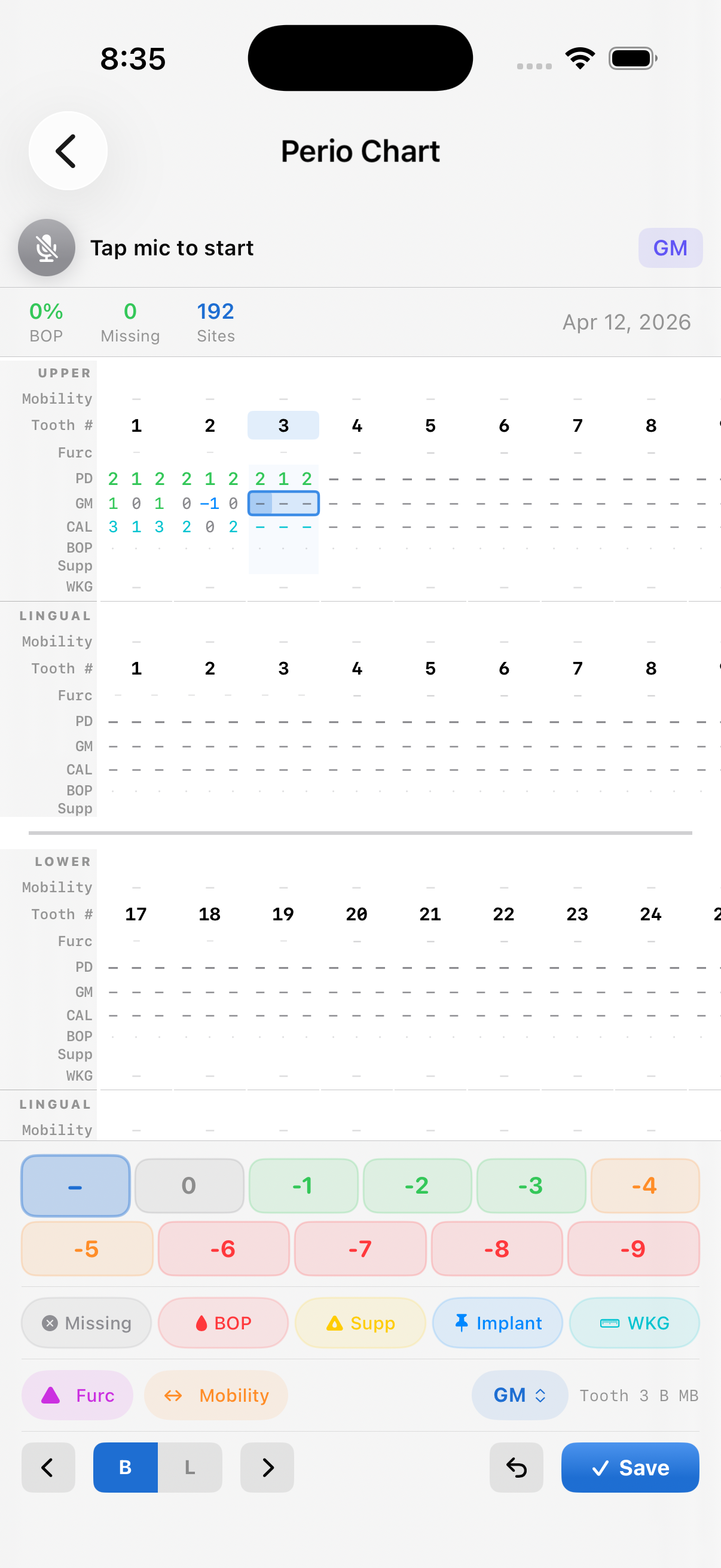PerioMaxer charting view