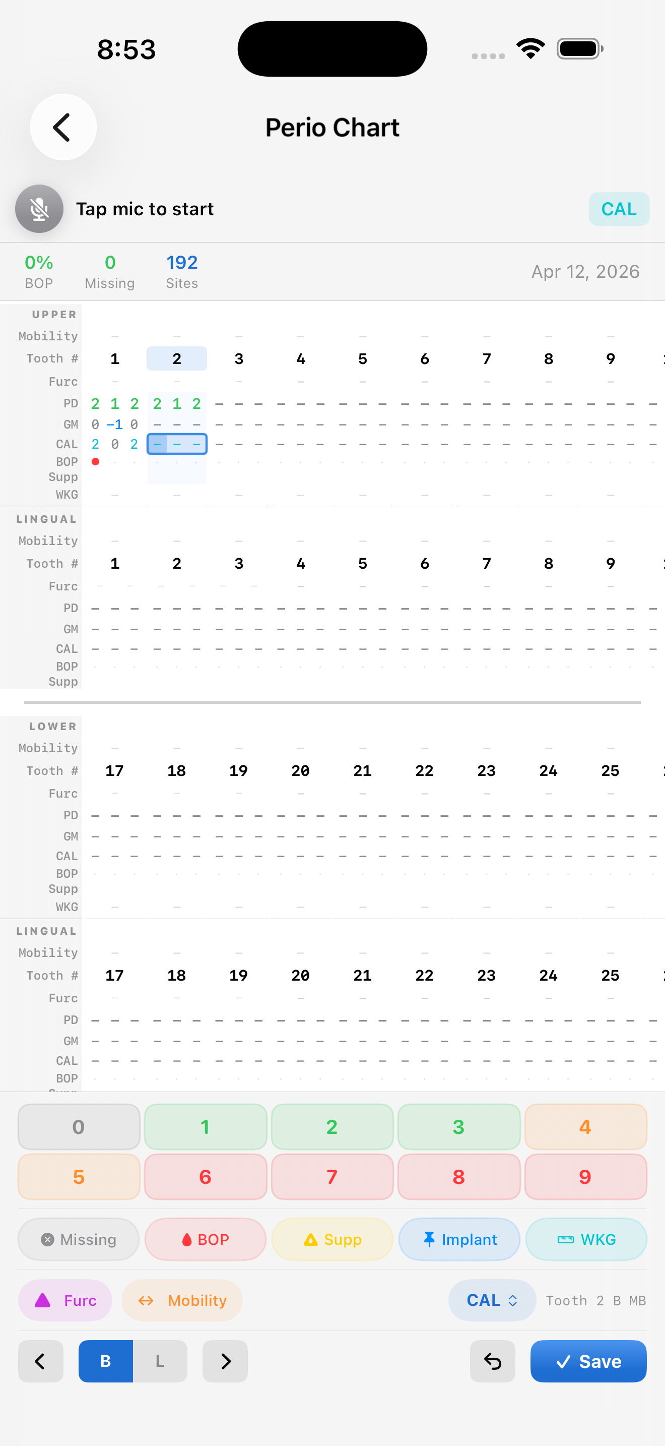 PerioMaxer charting detail